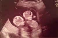 Twincesses's Avatar