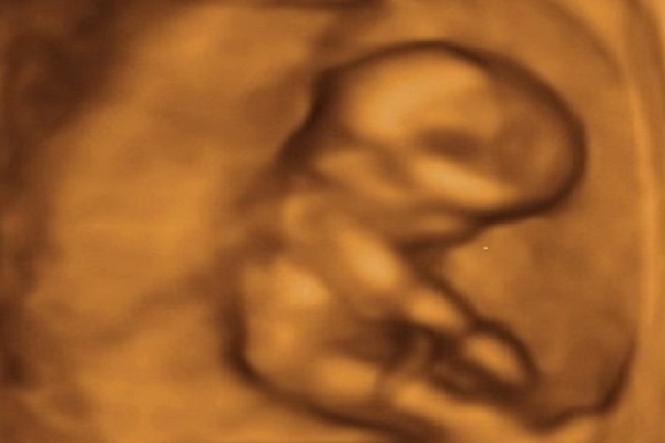 Week 14 - your week by week pregnancy