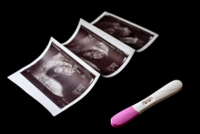 Week 12 – your pregnancy week by week