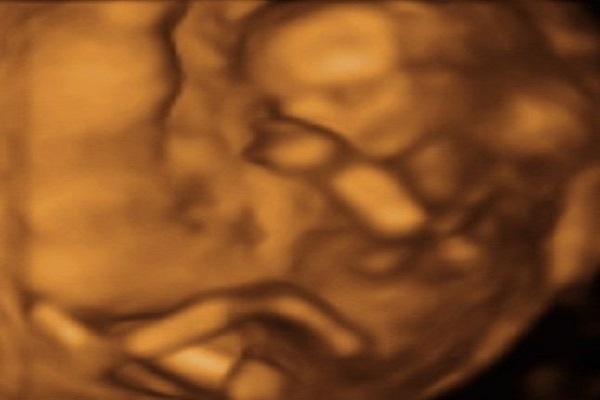 Week 16 - your week by week pregnancy