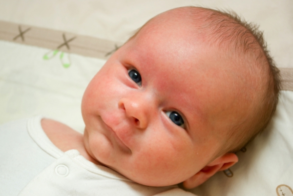 How do you know if your baby has allergies?
