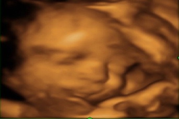 Week 30 - your week by week pregnancy