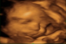 Week 30 - your week by week pregnancy
