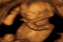 Week 15 - your week by week pregnancy